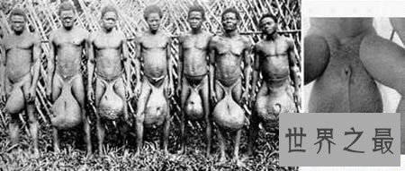 【图】象鼻族你知道长什么样子吗 他们真的有大鼻子吗