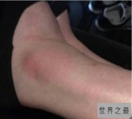 【图】维密第一摔!这一摔，还摔出个励志的鸡汤故事啦