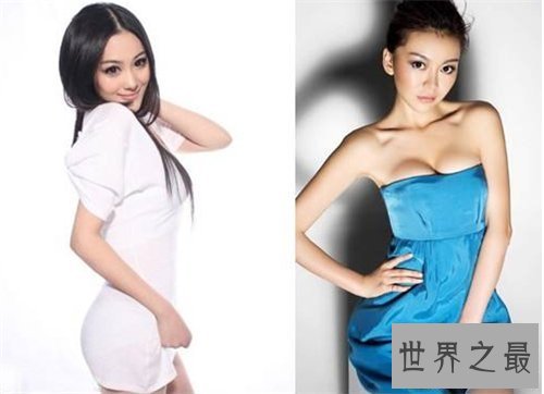 【图】巩新亮整容前后差异大 网友直呼惨不忍睹