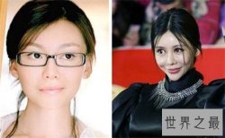 【图】巩新亮整容前后差异大 网友直呼惨不忍睹