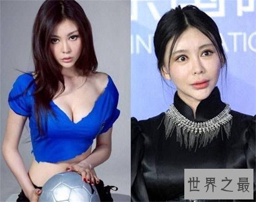 【图】巩新亮整容前后差异大 网友直呼惨不忍睹