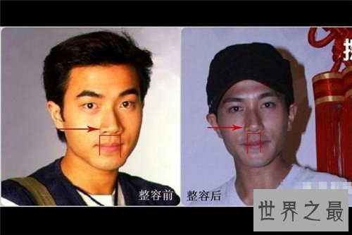 【图】刘恺威整容前后对比照 如今的刘恺威更具备男人