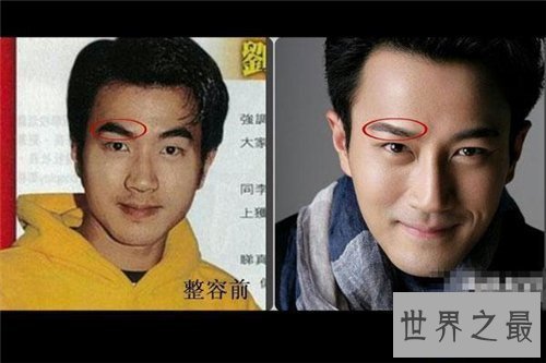 【图】刘恺威整容前后对比照 如今的刘恺威更具备男人