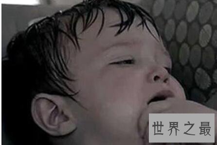 【图】盗汗是什么意思为什么会出现盗汗该怎样去预防