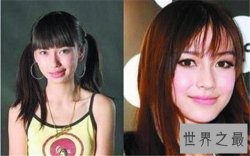 【图】杨颖整容前后大对比 整张脸变了只是摘牙套吗