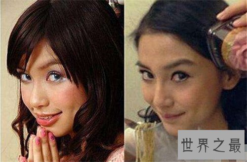 【图】杨颖整容前后大对比 整张脸变了只是摘牙套吗