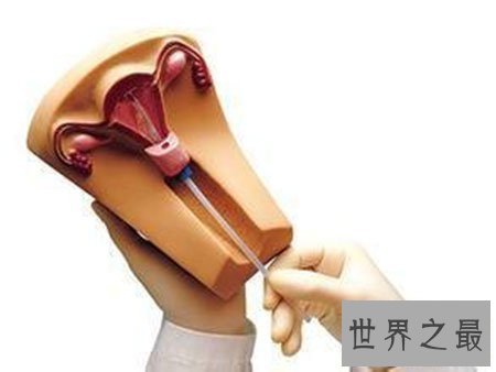 【图】节育环图片到底是什么样子 就仅仅是一个环吗