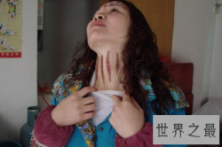 【图】扭痧之法 人人都可以学会 你也值得拥有