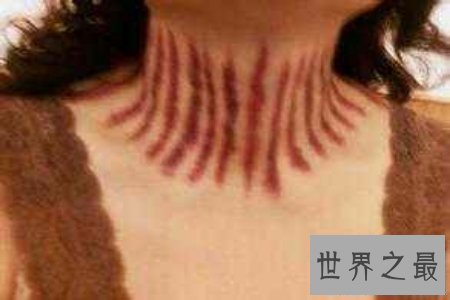 【图】扭痧之法 人人都可能学会 你也值得领有