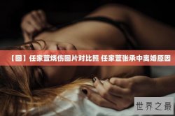 【图】任家萱烧伤图片对比照 任家萱张承中离婚原因