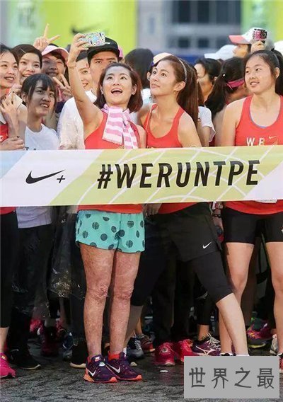 【图】任家萱烧伤图片对比照 任家萱张承中离婚缘由