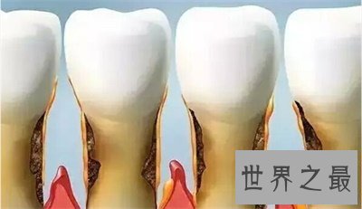 【图】梦见牙齿松动原来象征着这些 太神奇了