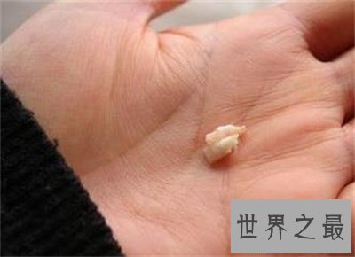 【图】梦见牙齿松动原来象征着这些 太神奇了