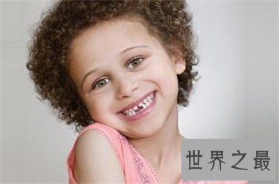 【图】梦见牙齿松动原来象征着这些 太神奇了