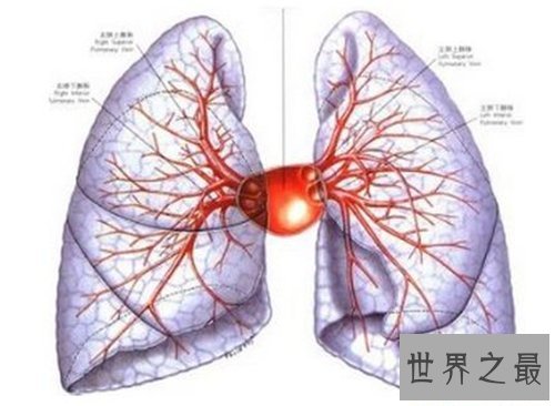 【图】肺部纤维化病因原由引见 症状以及治疗方法引见