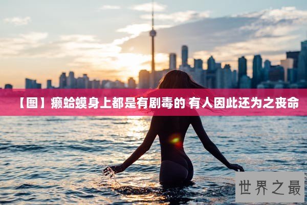 【图】癞蛤蟆身上都是有剧毒的 有人因此还为之丧命