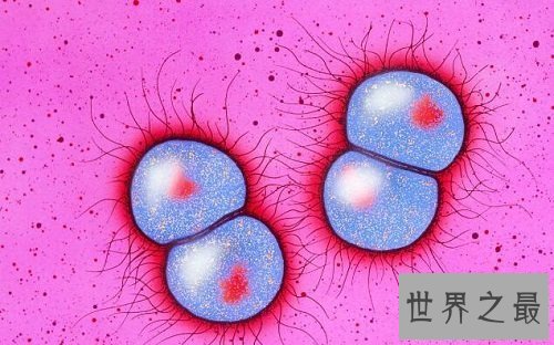 【图】女性男性的最大克星除了癌症还有淋病淋病的症