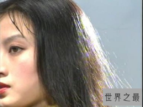 【图】头皮屑多，他人总是晴空万里，而你却是四月飞