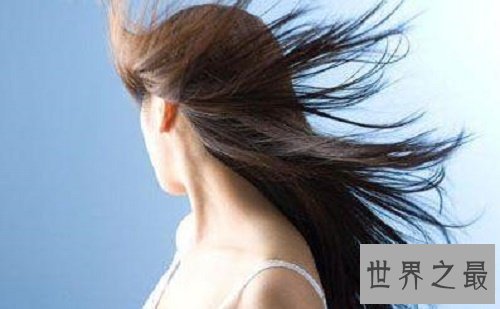 【图】头皮屑多，他人总是晴空万里，而你却是四月飞