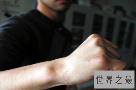 【图】了解恐艾 克制恐艾 争做一个心思瘦弱人