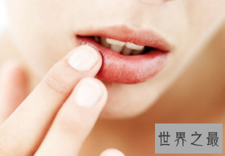 【图】牙髓发炎的基本性治疗就是根管治疗 十分有效