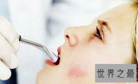 【图】牙髓发炎的基本性治疗就是根管治疗 十分有效