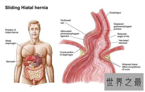 【图】人体内脏图具体解析 人体内脏的工作工夫引见