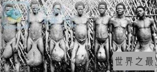 【图】世界上最大的性器官长达56厘米人类之最