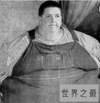 【图】世界第一胖体重高达10多个一般成人的分量