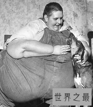 【图】世界第一胖体重高达10多个一般成人的分量