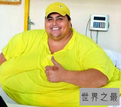 【图】世界第一胖体重高达10多个一般成人的分量
