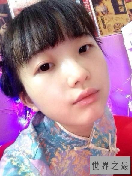 【图】36岁少女童姥真有此人 发微博廓清本人没有炒作