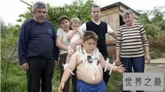 【图】揭秘事实中十大变异人 领有像科幻电影中的超级