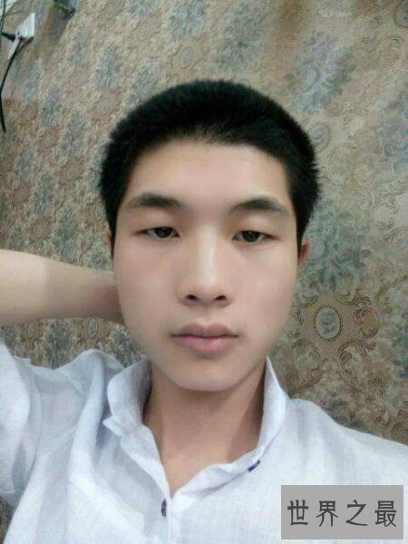 【图】一种常见的生理现象三角眼 咱们该怎样矫正