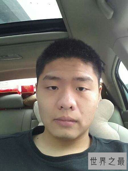 【图】一种常见的生理现象三角眼 咱们该怎样矫正