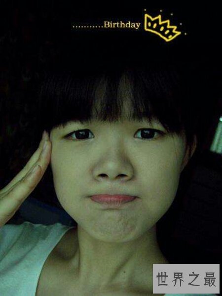 【图】一种常见的生理现象三角眼 咱们该怎样矫正