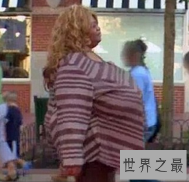 【图】世界上最大的胸 双乳重达77斤真的有人青睐吗
