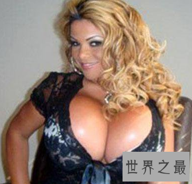 【图】世界上最大的胸 双乳重达77斤真的有人青睐吗