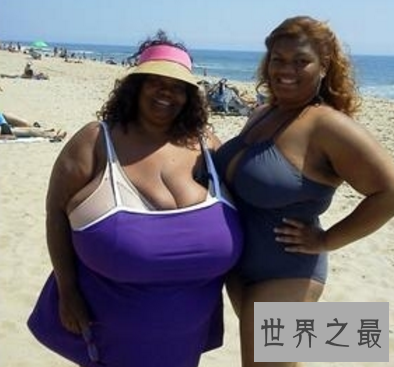 【图】世界上最大的胸 双乳重达77斤真的有人青睐吗