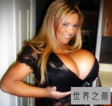 【图】世界上最大的胸 双乳重达77斤真的有人青睐吗
