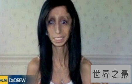 【图】世界最丑的女人是谁 是芙蓉姐姐吗