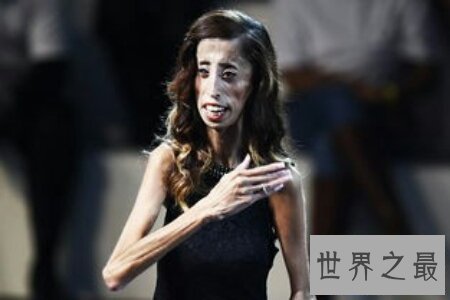 【图】世界最丑的女人是谁 是芙蓉姐姐吗