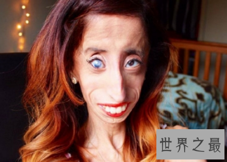 【图】世界最丑的女人是谁 是芙蓉姐姐吗