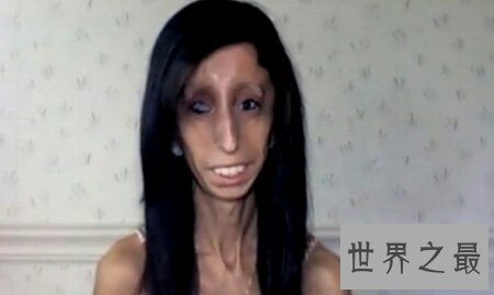 【图】世界最丑的女人是谁 是芙蓉姐姐吗