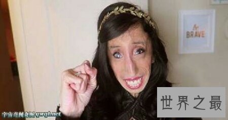 【图】世界最丑的女人是谁 是芙蓉姐姐吗