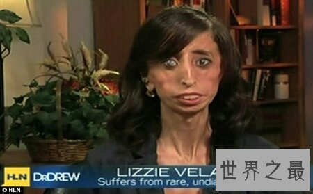 【图】世界最丑的女人是谁 是芙蓉姐姐吗