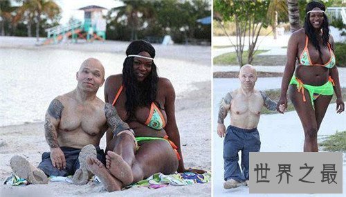 【图】阴阳人图片构成缘由引见 泰国人妖并不属于阴阳