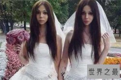 【图】阴阳人图片形成原因介绍 泰国人妖并不属于阴阳