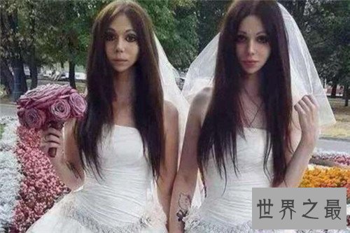【图】阴阳人图片构成缘由引见 泰国人妖并不属于阴阳