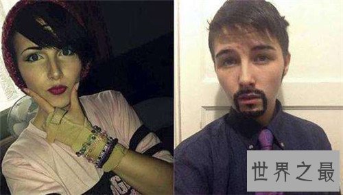 【图】阴阳人图片构成缘由引见 泰国人妖并不属于阴阳
